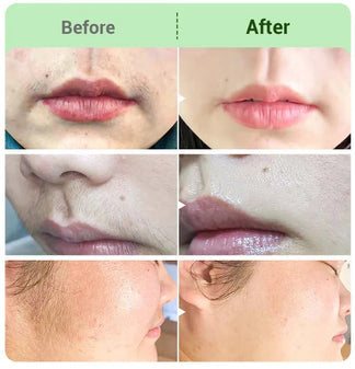 | Painless Hair Removal Cream for Hormonal Facial Hair Dermatologist-Recommended | Smooth, Flawless Skin Without Irritation | Quick & Long- Lasting Results❤❤❤❤